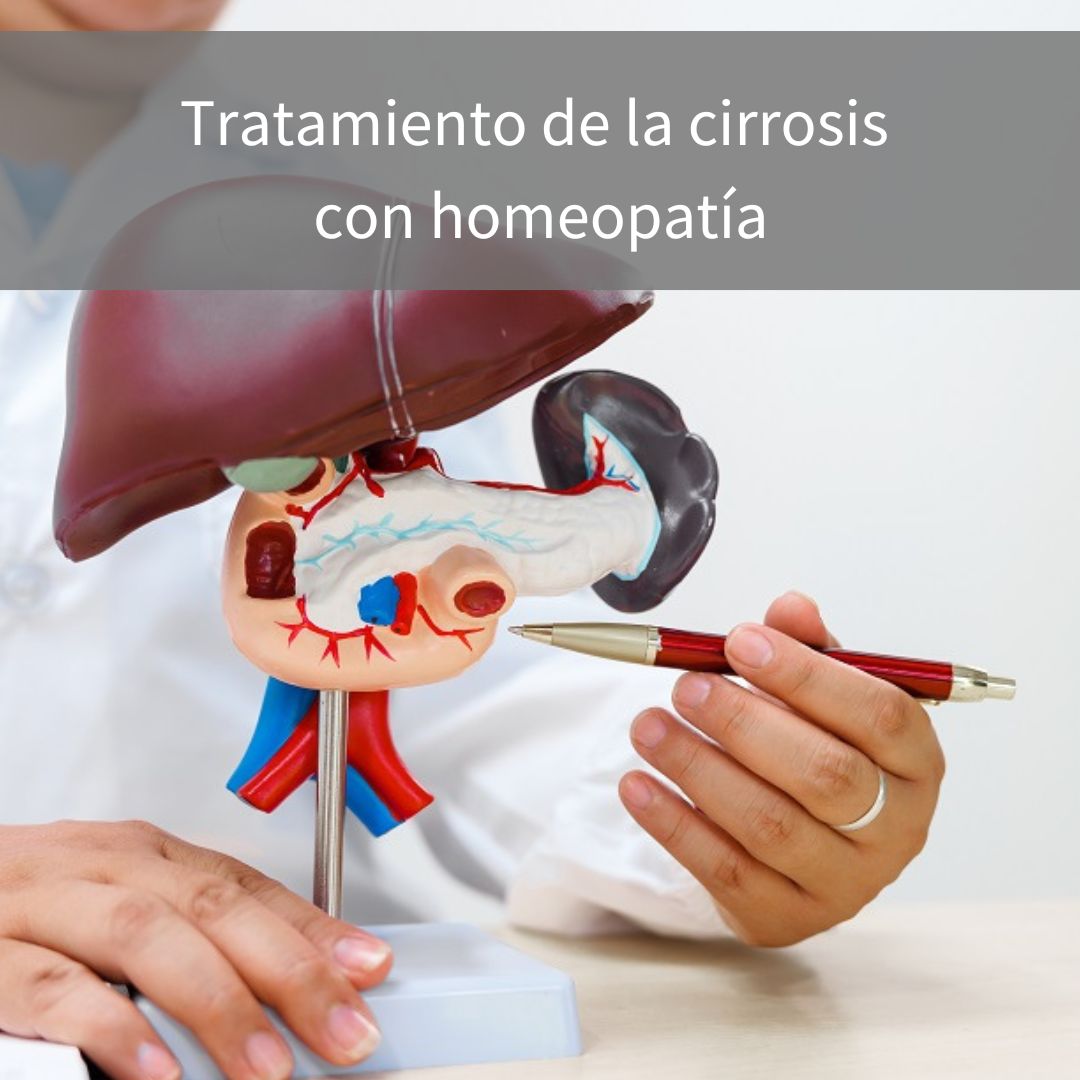 🔎 La #cirrosis hepática produce una alteración de la estructura del hígado que conlleva una alteración de sus funciones.

El <a href="/DrGBasauri/">Guillermo Basauri</a> explica las causas, síntomas y manifestaciones, el tratamiento convencional y cómo la #Homeopatía puede ayudar🌿.

▶ bit.ly/4dToLYv