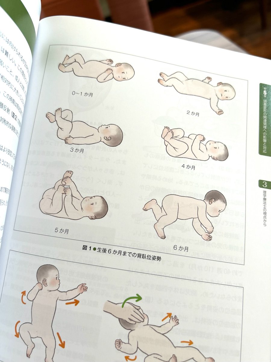 inoue_bonbon's tweet image. 🌸お仕事紹介
「改訂2版 小児の頭蓋健診・治療ハンドブック」
乳児の頭の形、運動の発達など、
診察のための専門書🤗
解説用の挿し絵のご依頼でした

曖昧にせず写実的に
かつ、温かみのあるタッチで

#乳児健診 #育児相談 #保健師 #助産師  #NICU #PT  #ヘルメット治療　 #イラストの依頼　#挿絵