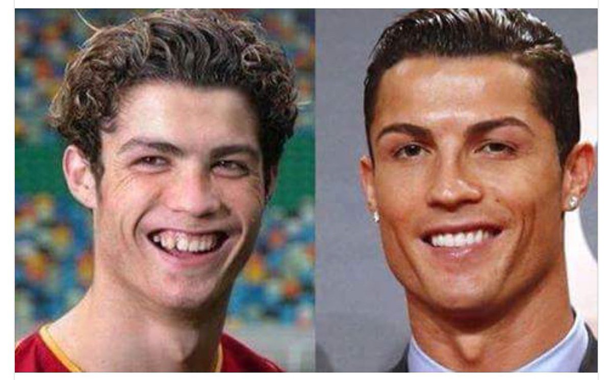 Yokolvd 👍 tweet media