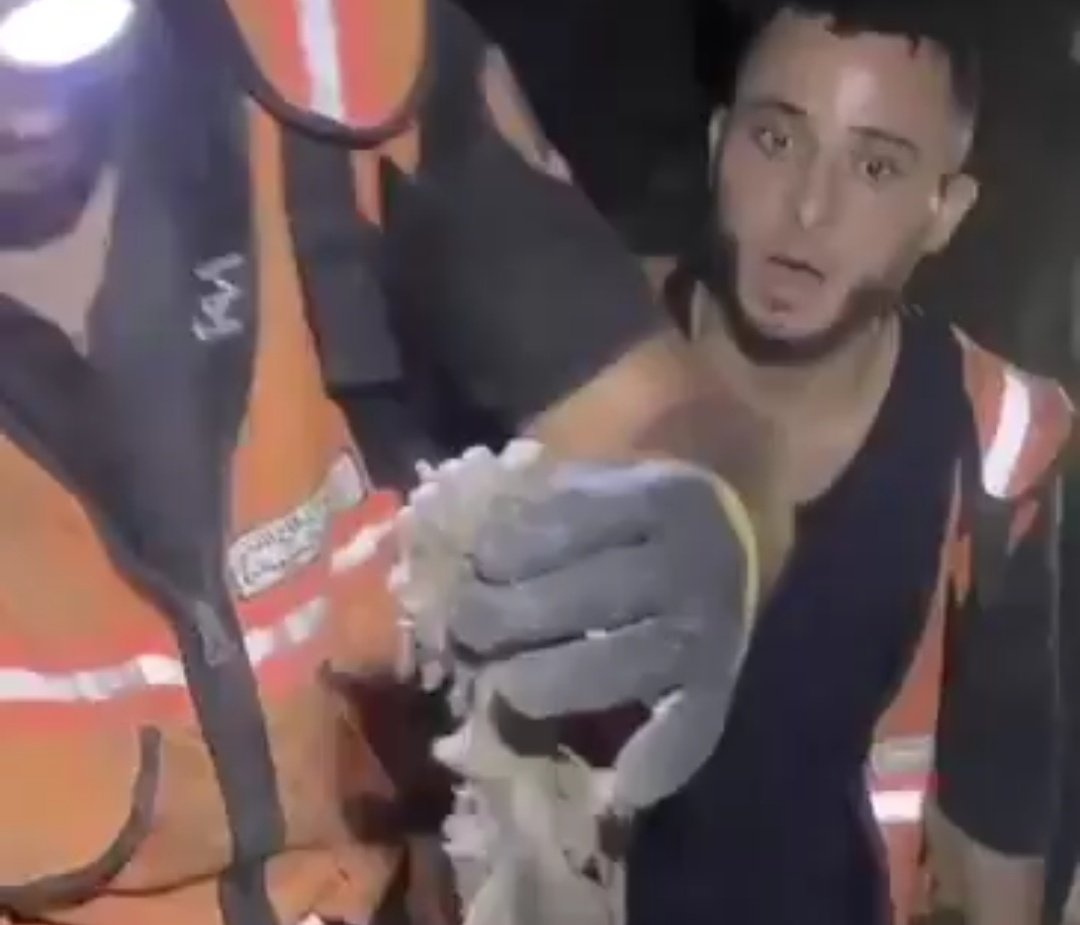 Abu_Salah9's tweet image. هذا المشهد الآن!
هذا ما تبقى من طفل! نصف قدم متبخر ومحترق
ردة فعل رجل الدفاع المدني تشرح كل شيء، ما يحدث صااادم .