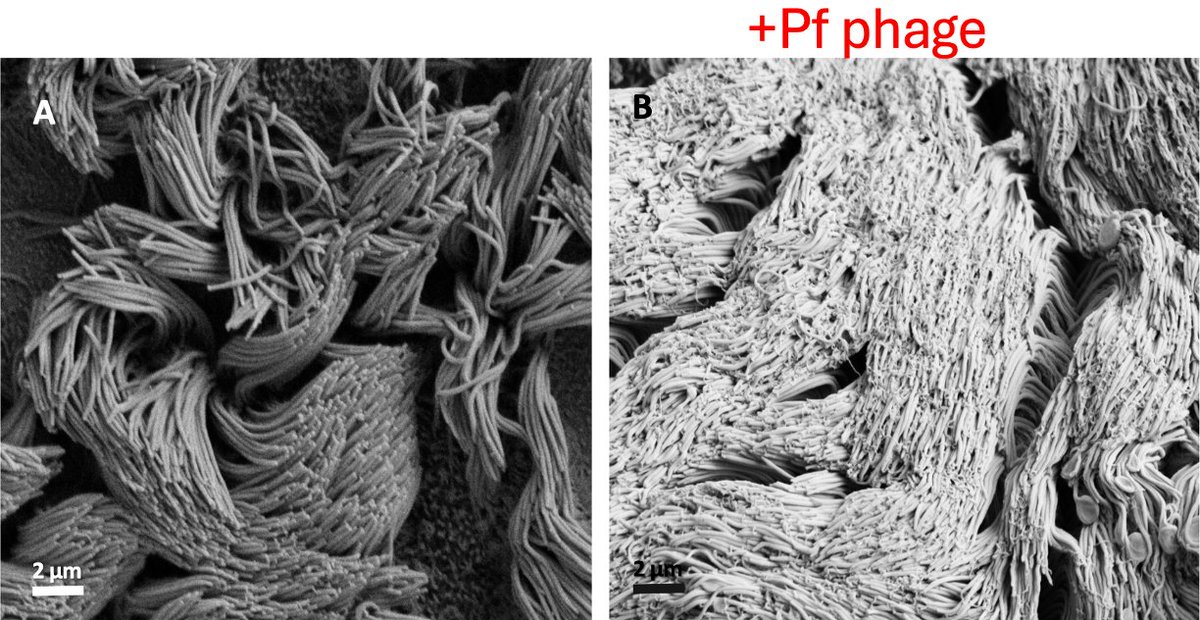 Paul Bollyky (@bollyky) on Twitter photo pf phage entangle cilia and mucins, preventing mucociliary clearance. Congratulations to <a href="/ebburgenerMD/">Elizabeth B Burgener</a> <a href="/PRSecor/">Patrick R. Secor</a> <a href="/cai_pam/">Pam Cai</a> <a href="/heilshornlab/">Heilshorn Lab</a> and Carlos Milla on this lovely work! doi.org/10.1093/pnasne⦠pf phage entangle cilia and mucins, preventing mucociliary clearance. Congratulations to <a href="/ebburgenerMD/">Elizabeth B Burgener</a> <a href="/PRSecor/">Patrick R. Secor</a> <a href="/cai_pam/">Pam Cai</a> <a href="/heilshornlab/">Heilshorn Lab</a> and Carlos Milla on this lovely work! doi.org/10.1093/pnasneā¦