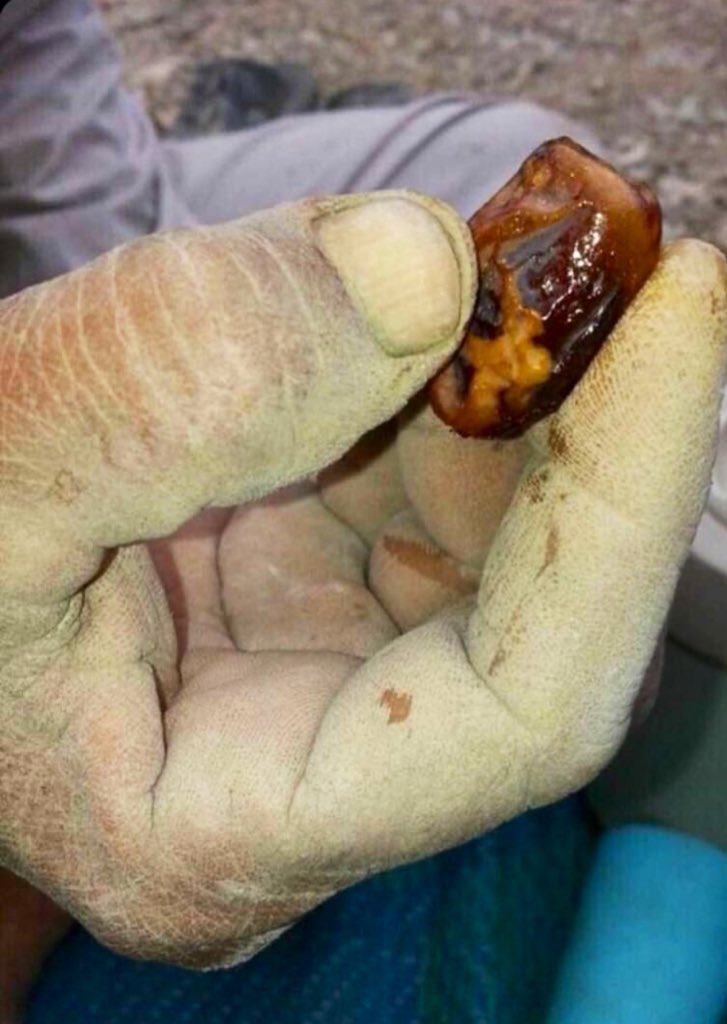 لو جتك التمرة هذي من يد ابوك وبالشكل هذا ، هل راح تقبلها وتاخذها ؟! 💔