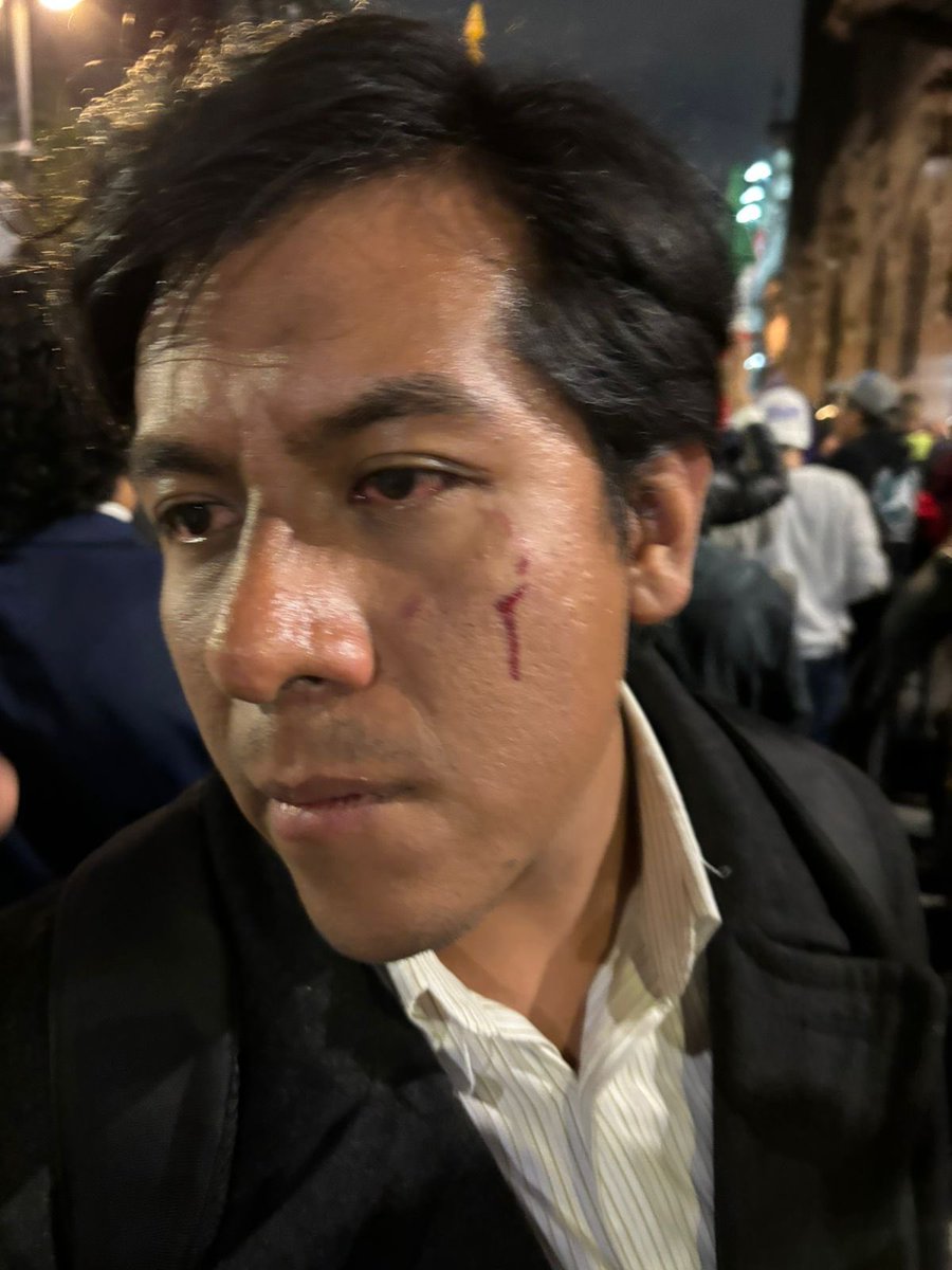 msantosguerrero's tweet photo. En estas condiciones se está votando la reforma en la sede alterna. Gente golpeada, con gas lacrimógeno, cientos de granaderos. Así la democracia mexicana de estos días… https://t.co/AcCFCAcHUU