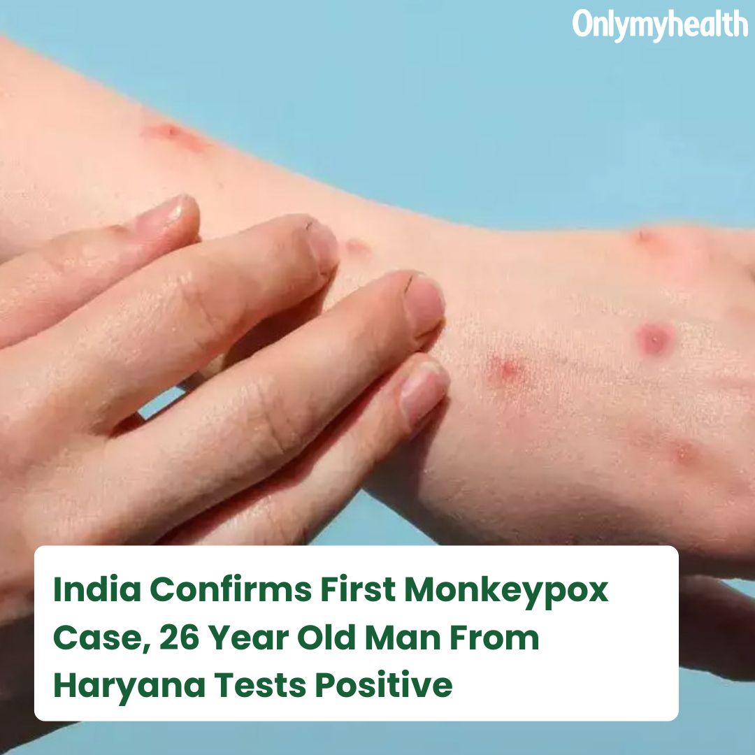 onlymyhealth's tweet photo. India has confirmed its first Mpox (previously known as monkeypox) case of 2024, sparking concerns about the country’s preparedness in the wake of its experience with the COVID-19 pandemic.
https://t.co/ZwrHVnXIKN
#skinrashes #health #monkeypox #haryana #india #onlymyhealth https://t.co/cyI8wU1RXj
