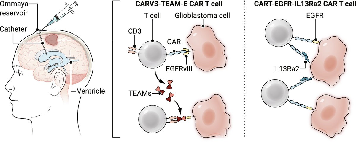 Science Magazine (@sciencemagazine) on Twitter photo Two recent phase 1 trials hint that bivalent #CARTcell therapies could overcome persistent barriers in the treatment of #glioblastoma, according to a new <a href="/ScienceTM/">Science Translational Medicine</a> Focus. scim.ag/8j2 Two recent phase 1 trials hint that bivalent #CARTcell therapies could overcome persistent barriers in the treatment of #glioblastoma, according to a new <a href="/ScienceTM/">Science Translational Medicine</a> Focus. scim.ag/8j2
