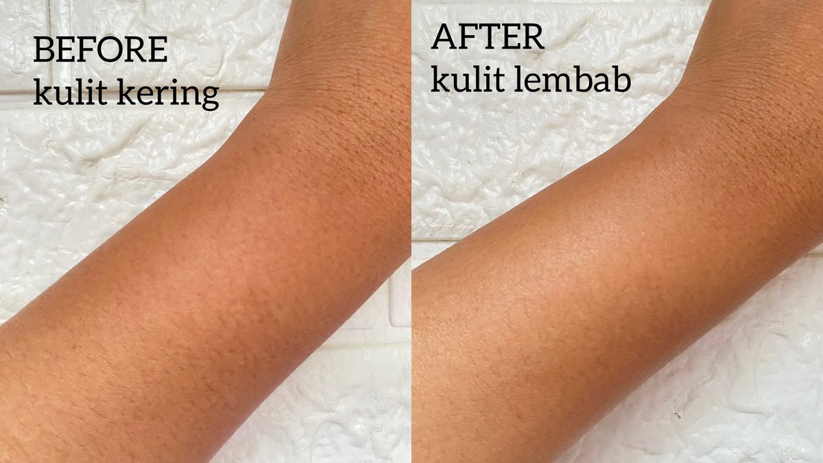 plumpypum's tweet image. Dari jaman collab sama BT21 sampe sekarang udah NEW PACKAGING masih tetep jadi andalan buat melembabkan sekaligus melindungi kulit dari sinar matahari

BYE KULIT KERING DAN BELANG 👋👋