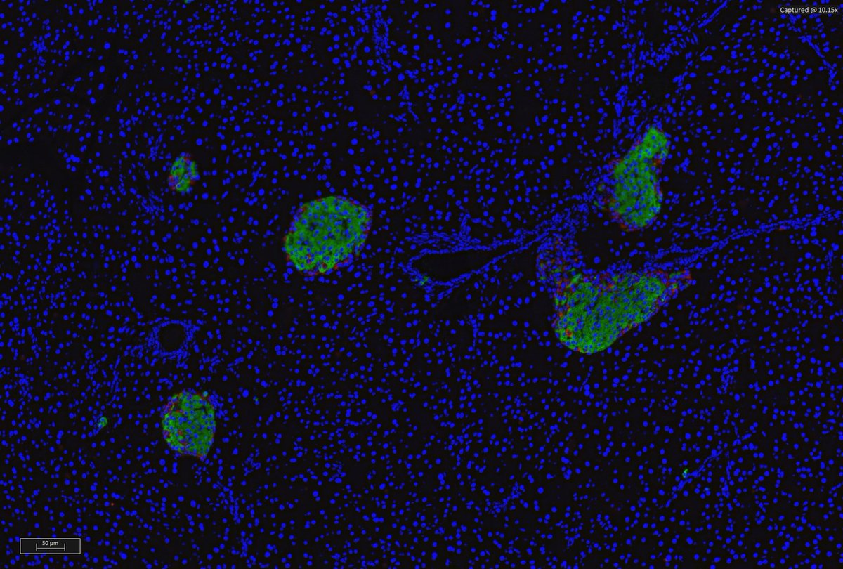 La régulation de la glycémie passe aussi par l’odorat ! 🧠👃 Une étude dirigée par le Pr Christophe Magnan montre comment les odeurs alimentaires influencent la sécrétion d’insuline via le bulbe olfactif et l’hypothalamus. @cnrs 
🔗  swll.to/SLHNi