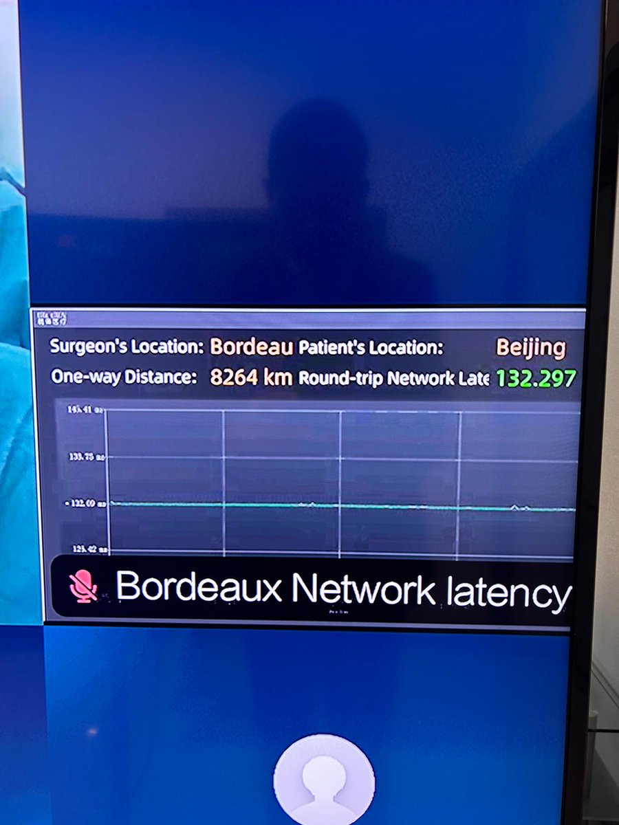 Fundació Puigvert Barcelona (@fpuigvert) on Twitter photo Prof. <a href="/AlbertoBreda1/">Alberto Breda</a> is ready to start partial nephrectomy via #telesurgery from Bordeaux to Beijing, 8264 km and 132 milliseconds latency.
Historic surgical event taking place today as part of the <a href="/ERUSrobotics/">ERUS Robotic Urology</a> congress in Bordeaux (France). Prof. <a href="/AlbertoBreda1/">Alberto Breda</a> is ready to start partial nephrectomy via #telesurgery from Bordeaux to Beijing, 8264 km and 132 milliseconds latency.
Historic surgical event taking place today as part of the <a href="/ERUSrobotics/">ERUS Robotic Urology</a> congress in Bordeaux (France).