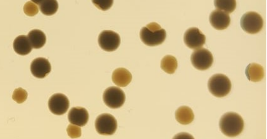 Centro Nacional de Biotecnología (CSIC) (@cnb_csic) on Twitter photo Revelan un mecanismo que acelera la evolución de bacterias resistentes a los antibióticos gracias a elementos llamados secuencias de inserción que se transfieren desde plásmidos al genoma bacteriano
Más info bit.ly/3zhFbeb
Artículo <a href="/NatureEcoEvo/">NatureEcoEvo</a> doi.org/10.1038/s41559… Revelan un mecanismo que acelera la evolución de bacterias resistentes a los antibióticos gracias a elementos llamados secuencias de inserción que se transfieren desde plásmidos al genoma bacteriano
Más info bit.ly/3zhFbeb
Artículo <a href="/NatureEcoEvo/">NatureEcoEvo</a> doi.org/10.1038/s41559…