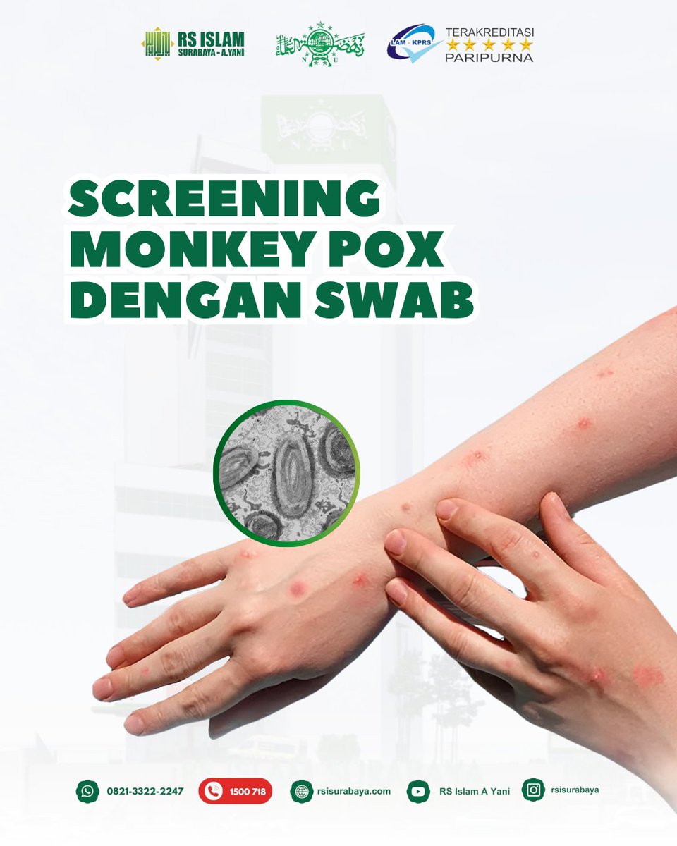 rsiayani's tweet image. Screening monkey pox dengan swab?🤔

Sobat eRSIy 

🦠🤔 Penasaran tentang Monkeypox? Yuk, intip kenapa screening dengan swab bisa jadi langkah awal yang penting! 📊🔬

#MonkeypoxScreening #SwabTest #CekKesehatan #MonkeyPox