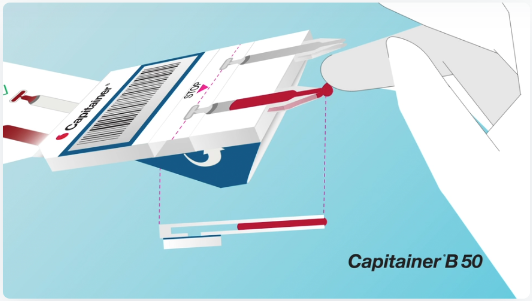 Stratech_UK's tweet image. .#Capitainer® qDBS tech for easy &amp;amp; accurate #selfsampling uses a combination of paper polymer #microfluidics &amp;amp; thin watersoluble membranes to meter a fixed volume of #blood of 10ul or 50ul Collected samples are compatible the @Luminex platform #diagnostics
stratech.co.uk/our-partners/c…