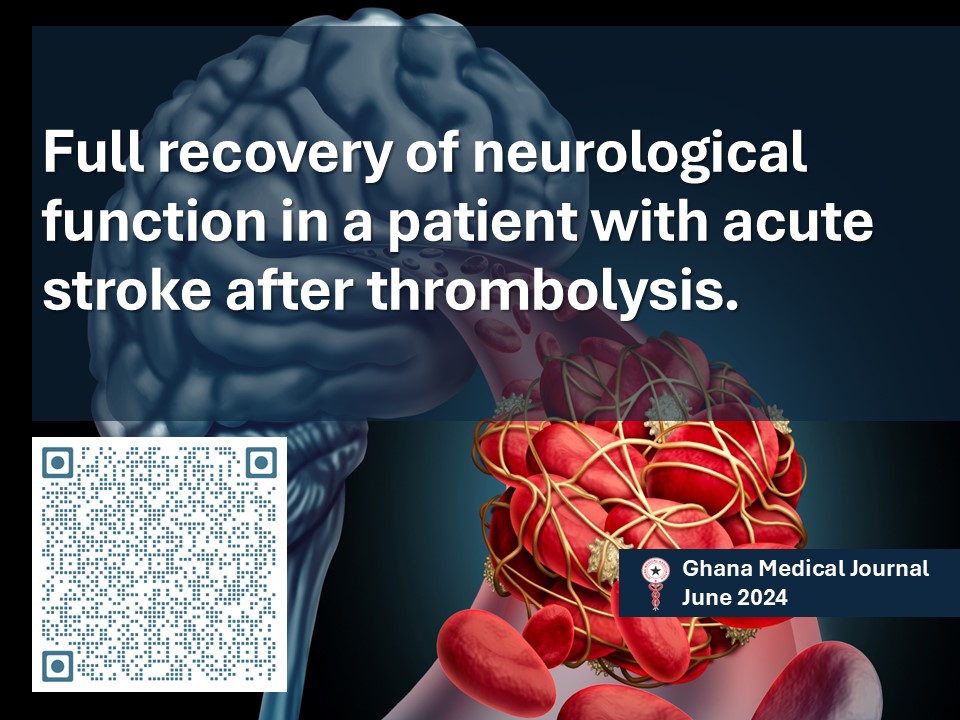 Ghana Medical Journal (@ghanamedj) on Twitter photo Recurrent ischemic stroke post-thrombolysis in an older Ghanaian woman
ghanamedj.org/articles/June2…
<a href="/GhanaMedAssoc/">Ghana Medical Association</a>
<a href="/ghanamedj/">Ghana Medical Journal</a>
<a href="/TheLancet/">The Lancet</a>
<a href="/WHO/">World Health Organization (WHO)</a>
<a href="/AfricaCDC/">Africa CDC</a>
<a href="/AJPPEditors/">African Journals</a>
<a href="/HeartandStroke/">Heart & Stroke</a>
<a href="/ischemic/">IschemicHeartDisease</a> Recurrent ischemic stroke post-thrombolysis in an older Ghanaian woman
ghanamedj.org/articles/June2…
<a href="/GhanaMedAssoc/">Ghana Medical Association</a>
<a href="/ghanamedj/">Ghana Medical Journal</a>
<a href="/TheLancet/">The Lancet</a>
<a href="/WHO/">World Health Organization (WHO)</a>
<a href="/AfricaCDC/">Africa CDC</a>
<a href="/AJPPEditors/">African Journals</a>
<a href="/HeartandStroke/">Heart & Stroke</a>
<a href="/ischemic/">IschemicHeartDisease</a>