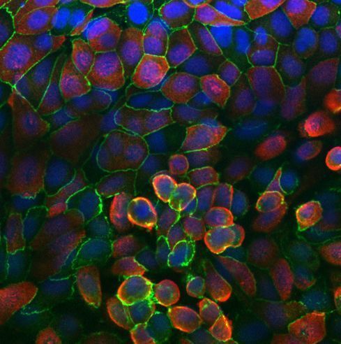 Microbiology Society (@microbiosoc) on Twitter photo Researchers from <a href="/thequadram/">Quadram Institute</a> working together with the <a href="/UKHSA/">UK Health Security Agency</a> have established a human “lung-on-chip” model that recreates how SARS-CoV-2 infects lung cells, in a contained laboratory environment. Researchers from <a href="/thequadram/">Quadram Institute</a> working together with the <a href="/UKHSA/">UK Health Security Agency</a> have established a human “lung-on-chip” model that recreates how SARS-CoV-2 infects lung cells, in a contained laboratory environment.