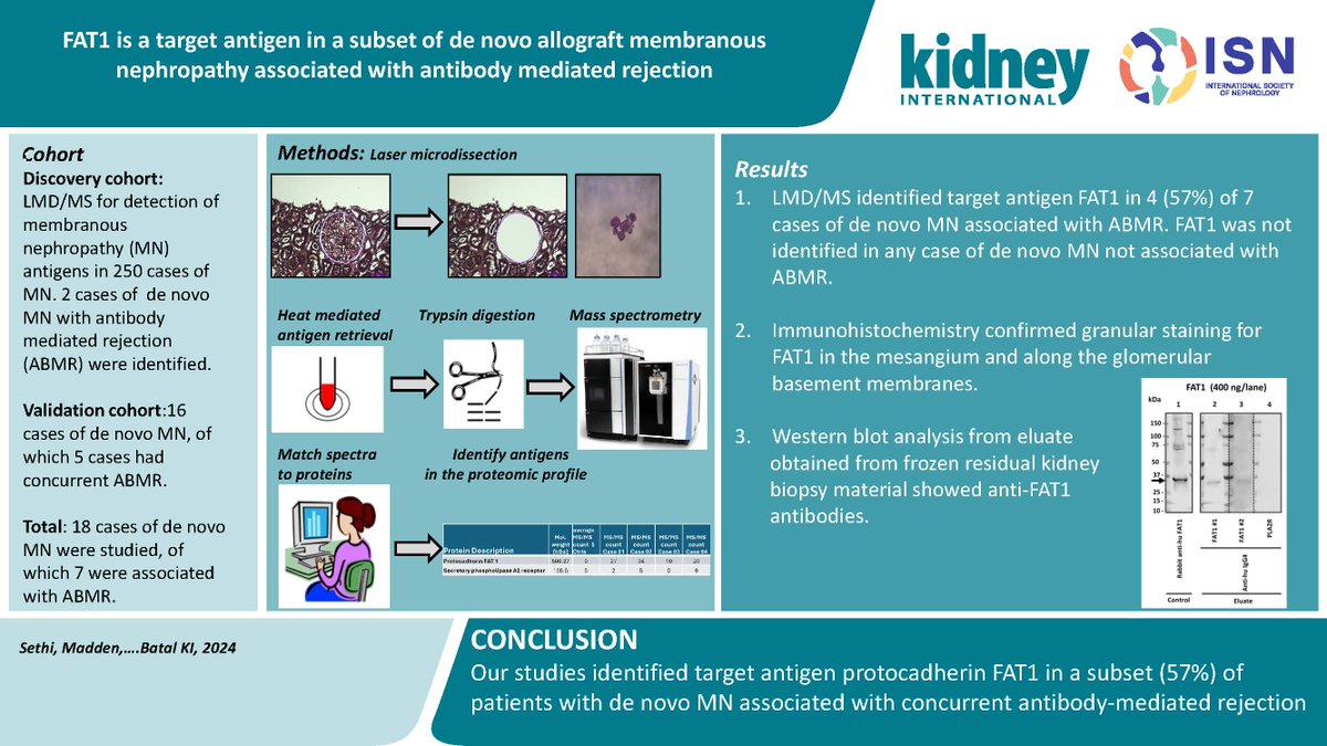 Kidney International (@kidney_int) on Twitter photo FAT1 is a target antigen in a subset of de novo allograft membranous nephropathy associated with antibody mediated rejection
doi.org/10.1016/j.kint…
#kidneytransplant <a href="/MayoClinic/">Mayo Clinic</a> <a href="/MayoClinicNeph/">Mayo Clinic Nephrology</a> <a href="/Inserm/">Inserm</a> <a href="/CHLeMans/">Centre Hospitalier du Mans</a> <a href="/ColumbiaPath/">Columbia Pathology</a> <a href="/ColumbiaMed/">Columbia Medicine</a> <a href="/MPAlexanderMD/">Priya Alexander, MD</a> <a href="/martacasalmoura/">Marta Casal Moura</a> FAT1 is a target antigen in a subset of de novo allograft membranous nephropathy associated with antibody mediated rejection
doi.org/10.1016/j.kint…
#kidneytransplant <a href="/MayoClinic/">Mayo Clinic</a> <a href="/MayoClinicNeph/">Mayo Clinic Nephrology</a> <a href="/Inserm/">Inserm</a> <a href="/CHLeMans/">Centre Hospitalier du Mans</a> <a href="/ColumbiaPath/">Columbia Pathology</a> <a href="/ColumbiaMed/">Columbia Medicine</a> <a href="/MPAlexanderMD/">Priya Alexander, MD</a> <a href="/martacasalmoura/">Marta Casal Moura</a>