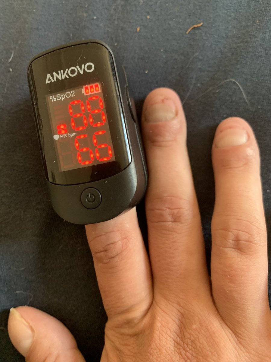 EllenJakeman's tweet photo. My blood oxygen is 87-88% and the soonest I can see a medical professional is a nurse is the 19th who would then decide whether it’s important enough to need to see a GP.
(Also yes all my nails are clubbed)

I love that we have an NHS but it would be really nice if it functioned. https://t.co/uaHpEKi2Xp