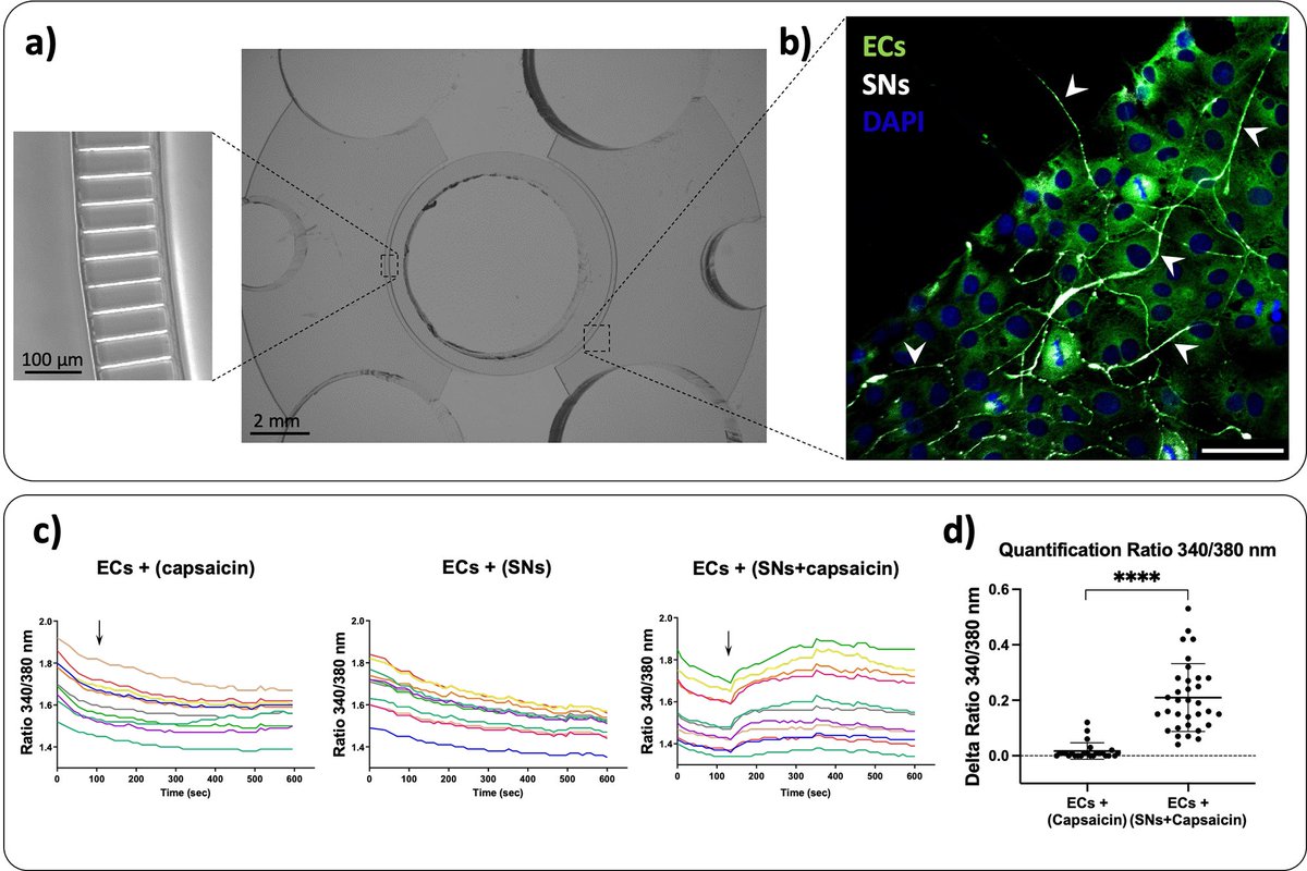 The effect of CGRP and SP and the cell signaling dialogue between sensory neurons and endothelial cells dlvr.it/TD633L