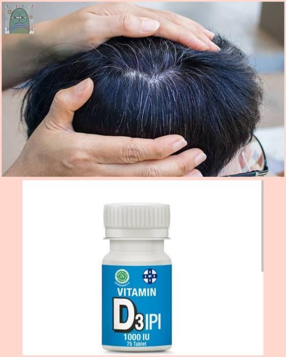 💚 ku kira aku ubanan karena udah tua padahal baru 30an ternyata aku kekurangan vitamin D. Awalnya konsumsi vitamin d karena rambut rontok tapi ngefek uban yang biasanya banyaak skrg hampir gada. Thank me later