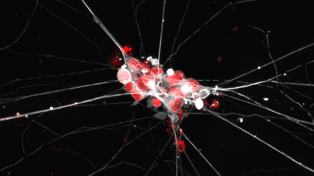 New scientific advances have also made it possible to replace animals in some types of research. 

At Bath, experiments into how pancreatic cancer affects nerve cells - grown from human stem cells - are finding new therapies to target tumour growth.

bath.ac.uk/case-studies/t…

.