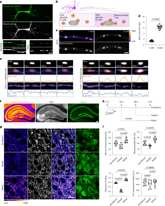 NatMetabolism's tweet photo. Online now! Organization of a functional glycolytic metabolon on mitochondria for metabolic efficiency https://t.co/gQRpM6dZMP https://t.co/QwMEZmJhNQ