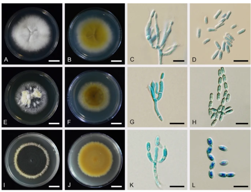 New in IMA Fungus:  Integrative taxonomy of Metarhizium anisopliae species complex, based on phylogenomics combined with morphometrics, metabolomics, and virulence data by Kobmoo et al.  Read now at: imafungus.biomedcentral.com/articles/10.11……
