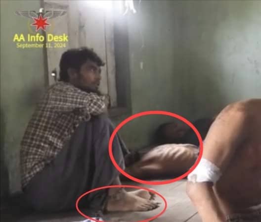 KMojibur74818's tweet photo. Do you see a chain tied with his leg? Where they escape from the bombardments? More #Rohingya innocent civilian captives have been detaining by #AA terrorists. Some were bombed and some are alive in the prison of AA terrorists.

Do you see how the captives surviving without food? https://t.co/uR0ZPFDrzi