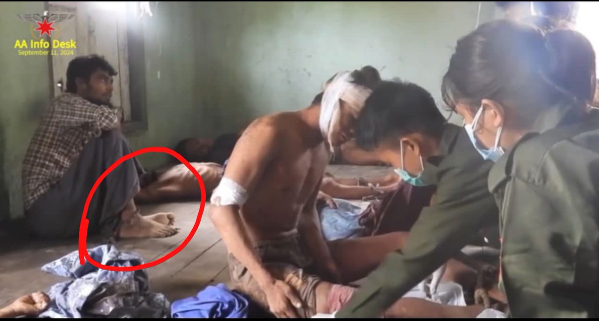 KMojibur74818's tweet photo. Do you see a chain tied with his leg? Where they escape from the bombardments? More #Rohingya innocent civilian captives have been detaining by #AA terrorists. Some were bombed and some are alive in the prison of AA terrorists.

Do you see how the captives surviving without food? https://t.co/uR0ZPFDrzi