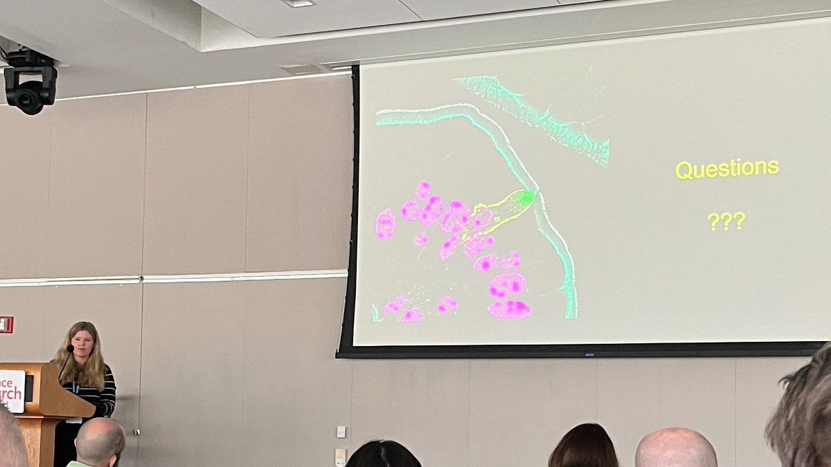 Stunning image! Enjoyed new study about intestinal tuft cells from <a href="/AmyEngevik/">Amy Engevik</a> lab:) #GTSRC24