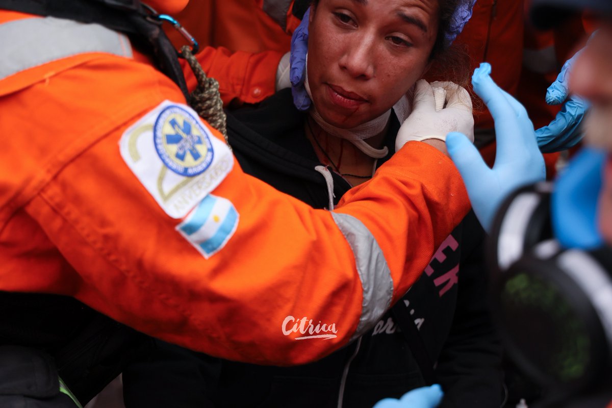revistacitrica's tweet photo. A esta piba la balearon en el cuello. La mujer se abraza a alguien que la contiene por el doble llanto: la traición del Congreso y la represión policial para garantizar el ajuste. Postales de la Argentina de Milei, año 1 de gobierno. ¿La ven? https://t.co/jWkQHkJejj