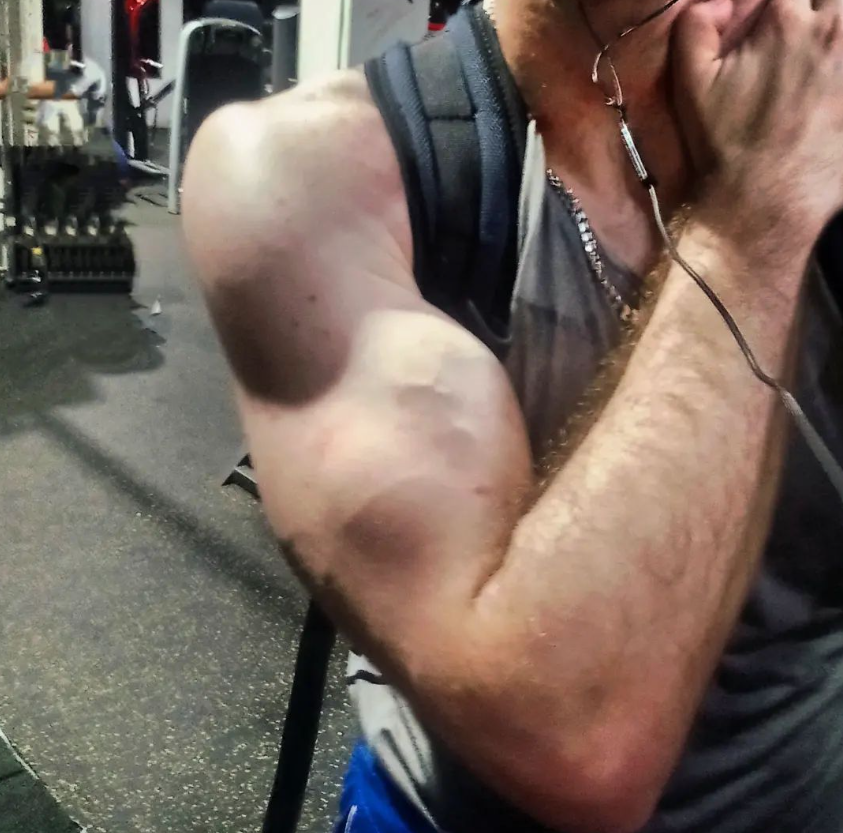 Side delt maxxing