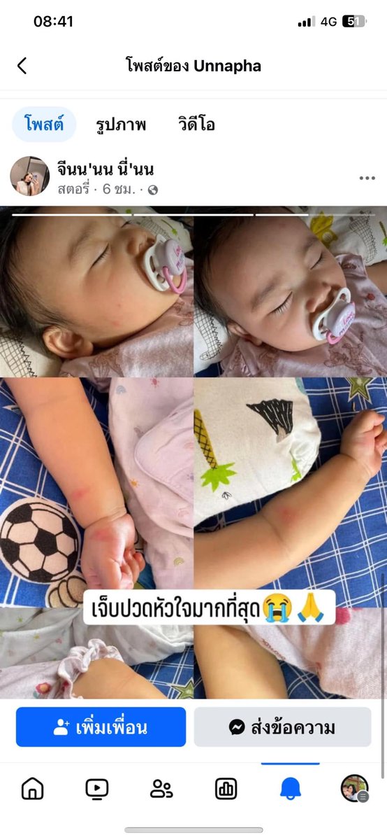 kunchalaaa's tweet photo. ช่วยเคสนี้หน่อยนะค่ะ มีเด็กวัย 9 เดือน เด็ก 3 ขวบ ยังไม่ได้รับการช่วยเหลือ น้องๆไม่ได้กินนม ไม่ได้กินข้าววันนี้เข้าวันที่ 3 เเล้ว ช่วยน้องทีค่ะ
พิกัด ต.เเม่สาย อยู่ติมในซอยค่ะ หมู่บ้านไม้ลุงขน บ้านเลขที่ 149 หมู่ 10 ต.เเม่สาย อ.เมือง จ.เชียงราย — ที่ ติม'ในซอย #น้ําท่วมเชียงราย https://t.co/Qa8Wabq2II