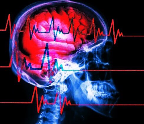 ¿Qué es la Neurología?

Especialidad médica encargada de prevenir, diagnosticar, tratar y rehabilitar enfermedades del sistema nervioso. Los neurólogos están preparados para manejar una variedad de condiciones, desde dolores de cabeza hasta enfermedades complejas.