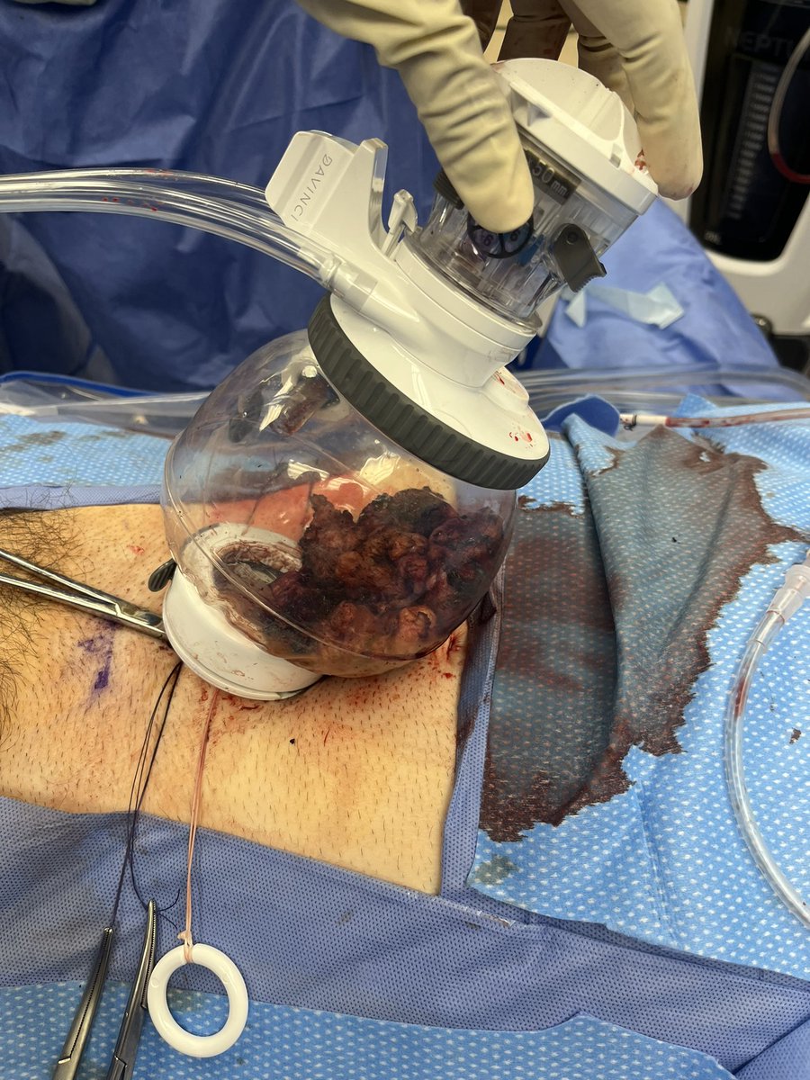 Jay S Chavali MD, MBBS tweet media