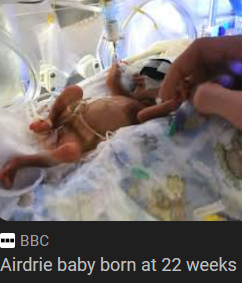 Jillybean_502's tweet image. #AbolishAbortion
#NoExceptions