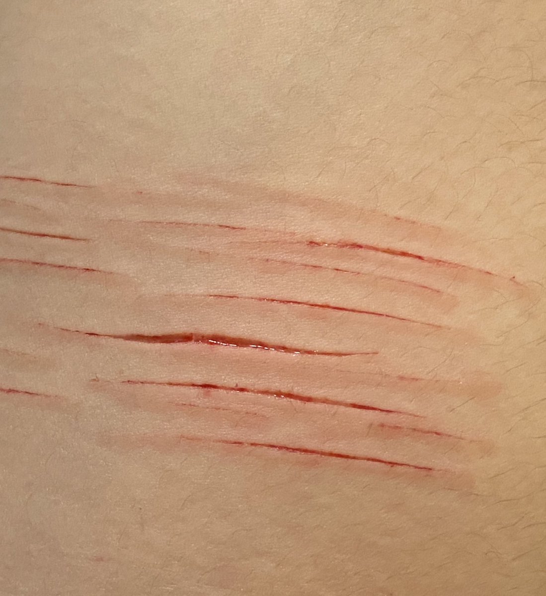 aricchi_sKy's tweet photo. Es la primera vez q me corto en este brazo, se ve lindo 
#styrocuts #babycuts #shtwt https://t.co/X090x11nsj