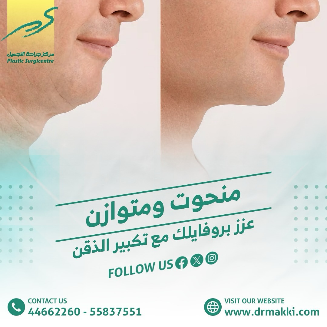 plasticsurgi's tweet photo. للحجز والاستفسار الرجاء التواصل مع مركز جراحة التجميل على :
For bookings and other inquires please call:
☎️ 44662260
☎️ 44676313
📱 55837551

.
#chin
#filler #plasticsurgery #breastaugmentation #liposuction #botoxforehead #botox #beautiful #wrinkles #plasticsurgicentre #drmakki https://t.co/d1vbfnO7HU