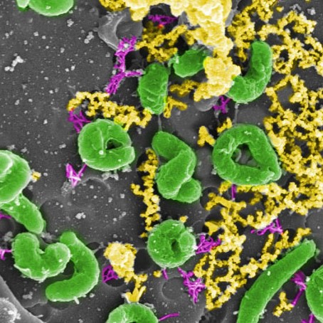 Are you interested in doing a PhD on biomining? Please check out the CSIRO industry PhD project on "Bioleaching of hyper-enriched black shales (HEBS)" with CSIRO, Australian National University and Bellavista Resources here: science.anu.edu.au/study/research…