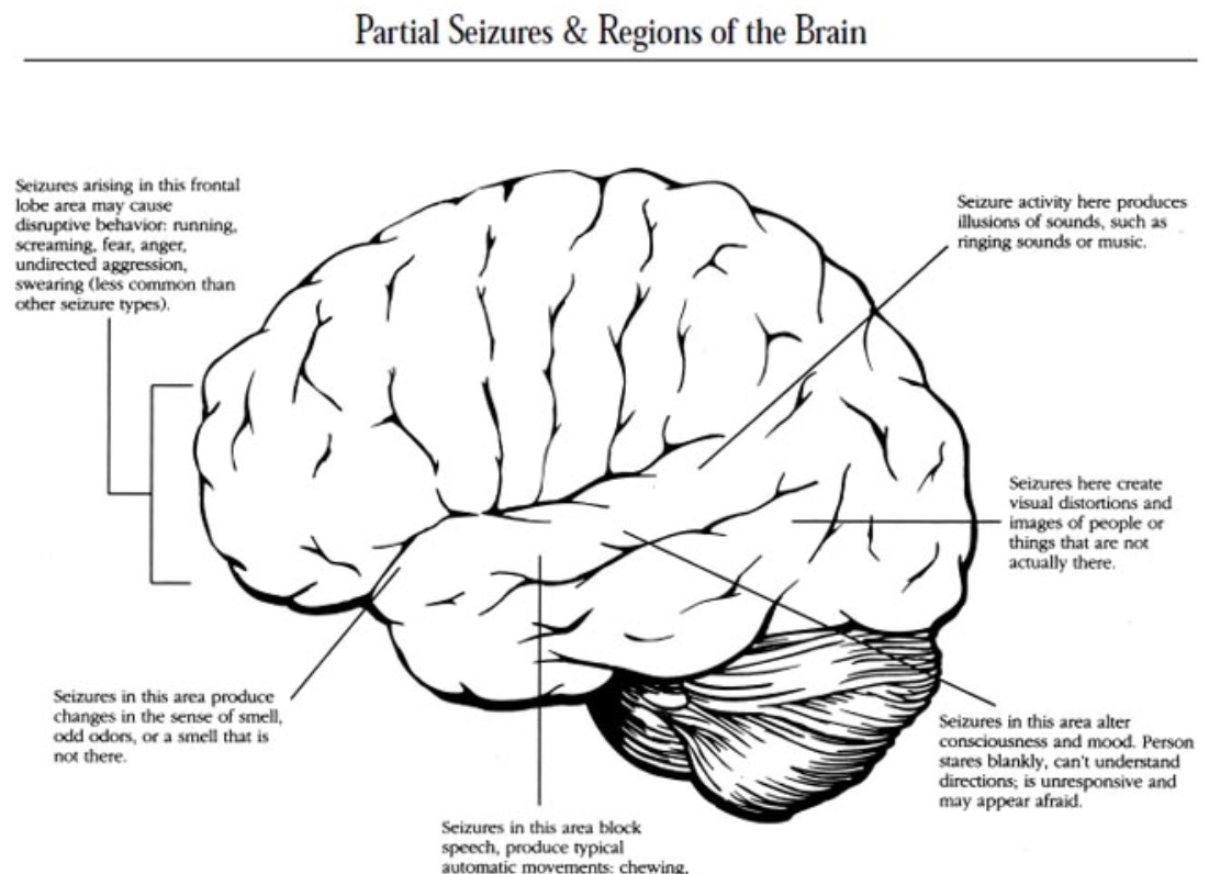 What Characterizes a Partial #Seizure? Simple or Complex?

epilepsy.com/what-is-epilep… by <a href="/EpilepsyFdn/">Epilepsy Foundation of America</a> Good read &amp; #education on the most common #epilepsy type. Meds can vary. <a href="/LorrieForseth/">Lorrie</a> <a href="/guy_amv/">epilepsy facts & opinions (minds of an epileptic)</a> <a href="/BrainAblaze/">Brain Ablaze</a> <a href="/TalkAboutItorg/">TalkAboutIt.org</a> <a href="/epilepsysociety/">Epilepsy Society</a> #Neurology #EpilepsyAwareness #health