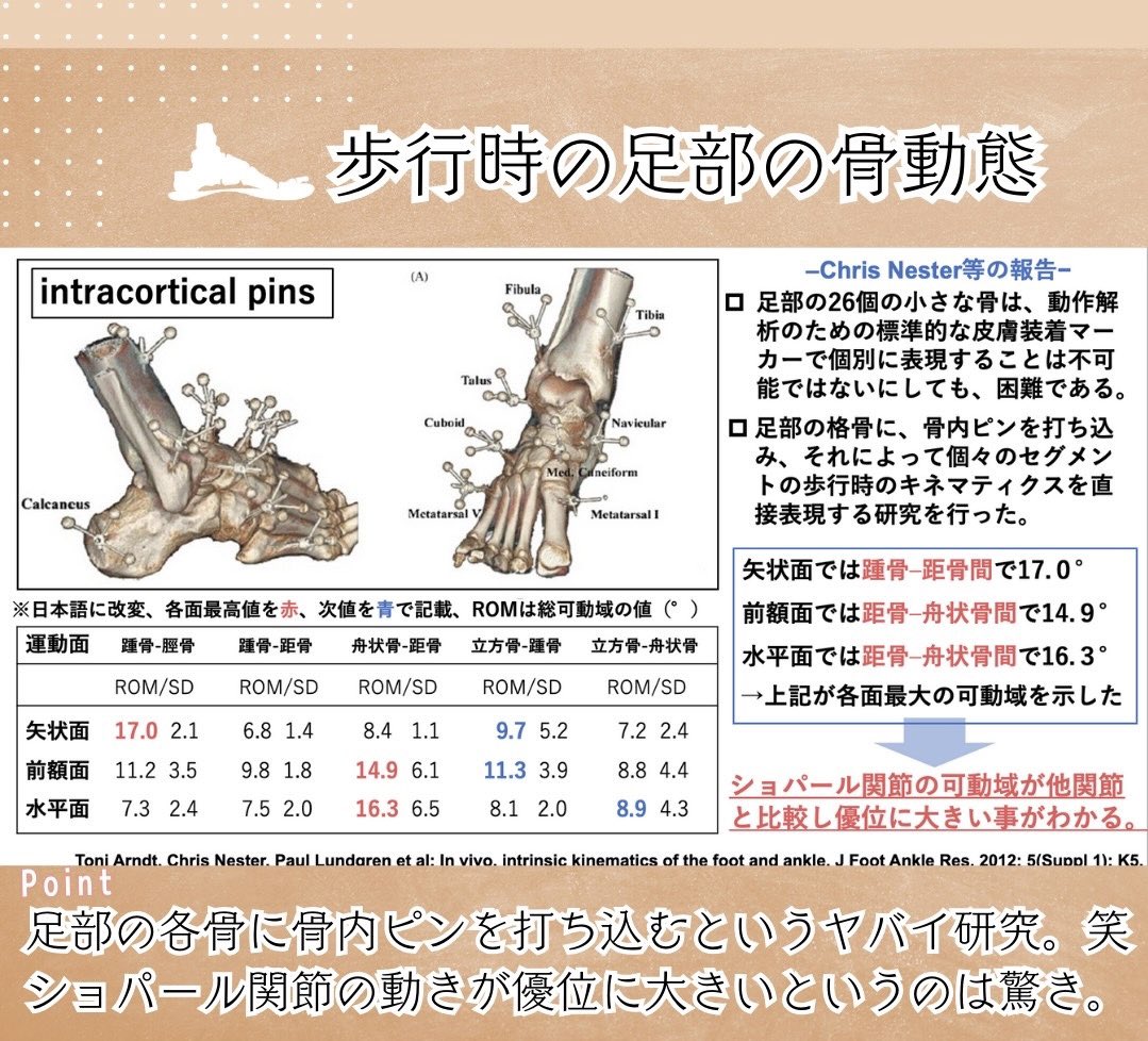 oshiroakito's tweet photo. 足部の研究報告まとめ🦶

最近では足部と歩行の
臨床研究も増えてる印象です。

実際に骨にピンを打ち込む
ぶっ飛び研究も。笑

ただ、全身との関連に関するものは
まだ少なくアートな要素も満載です。

だから足部がすきです。笑

#理学療法士
#続きはリプ欄
#Instagramはプロフへ
#姿勢反射おもろい https://t.co/vApY69GRby