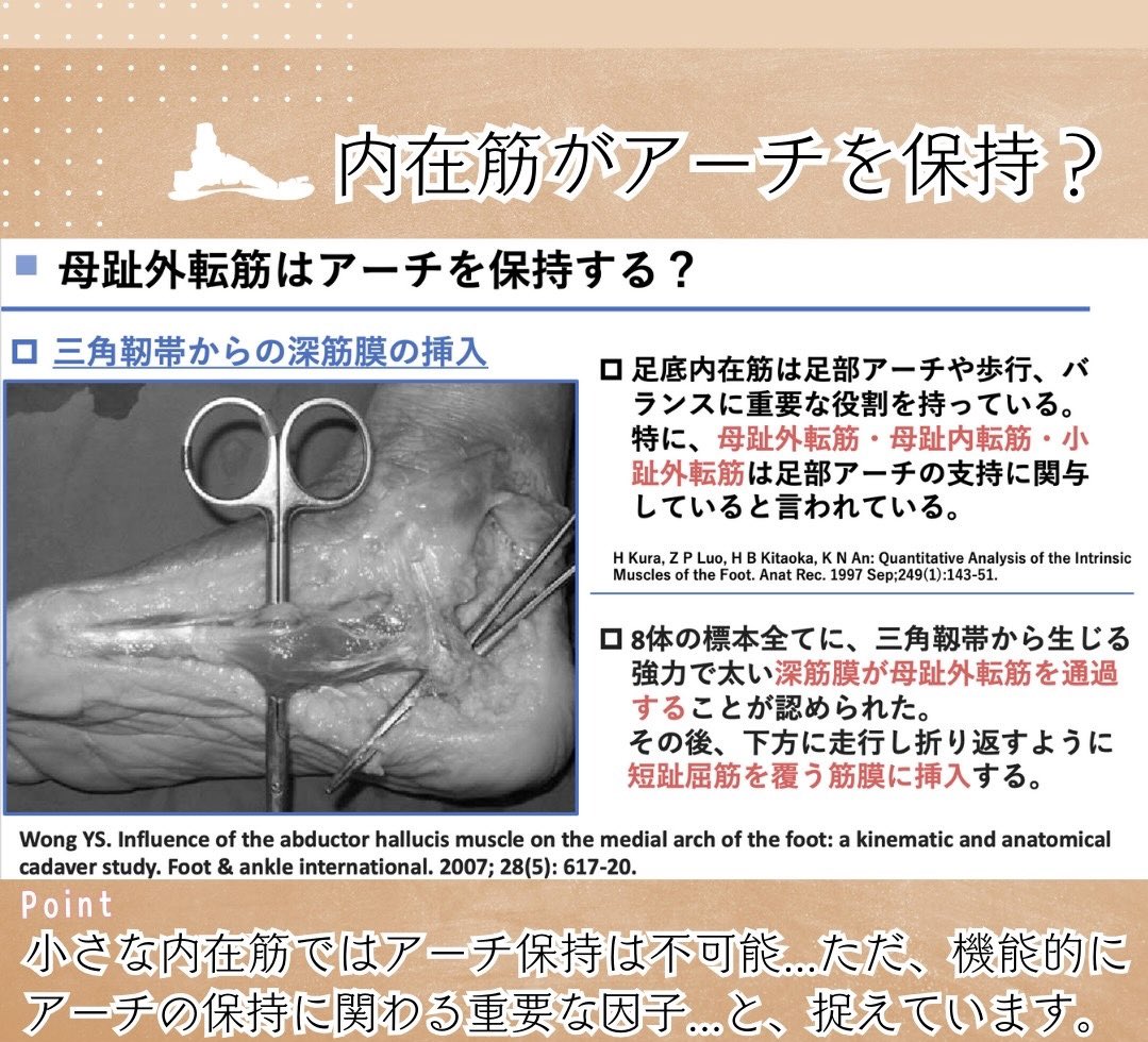 oshiroakito's tweet photo. 足部の研究報告まとめ🦶

最近では足部と歩行の
臨床研究も増えてる印象です。

実際に骨にピンを打ち込む
ぶっ飛び研究も。笑

ただ、全身との関連に関するものは
まだ少なくアートな要素も満載です。

だから足部がすきです。笑

#理学療法士
#続きはリプ欄
#Instagramはプロフへ
#姿勢反射おもろい https://t.co/vApY69GRby