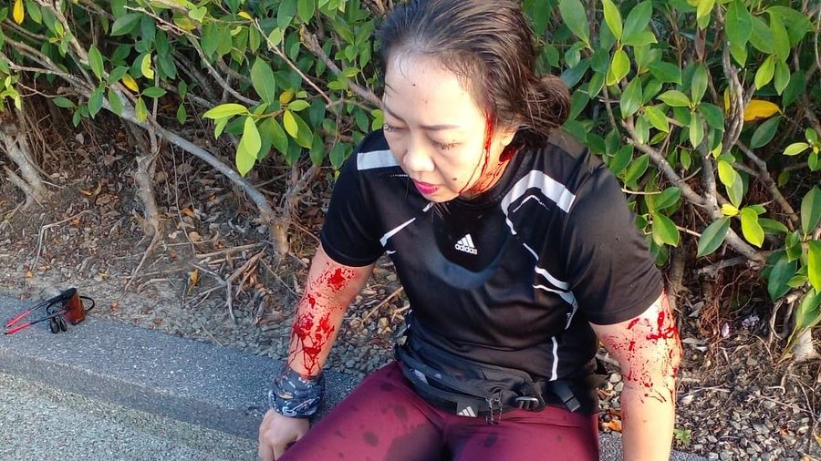 ApeHuncho's tweet photo. An unidentified woman was left in a pool of her blood after getting mauled by a gang of otters in Malaysia. 😵 https://t.co/ukJMDVWD7i