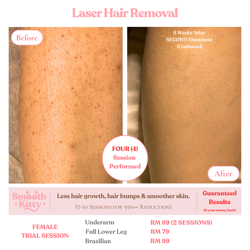 🌟 Laser Hair Removal🌟

Tired of the constant battle with razors, waxing, and endless plucking?

Experience the ultimate transformation with our Laser Hair Removal services, powered by the state-of-the-art Soprano Titanium laser!

✨ Our clients' results speak for themselves.