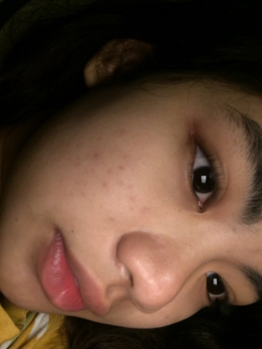 Mancing ikan pakai pengait

Angkut jala pakai sekuter

Km yg manis jaga kesehatan sebelum sakit

Sebelum gejala lgs tancap gas ke dokter