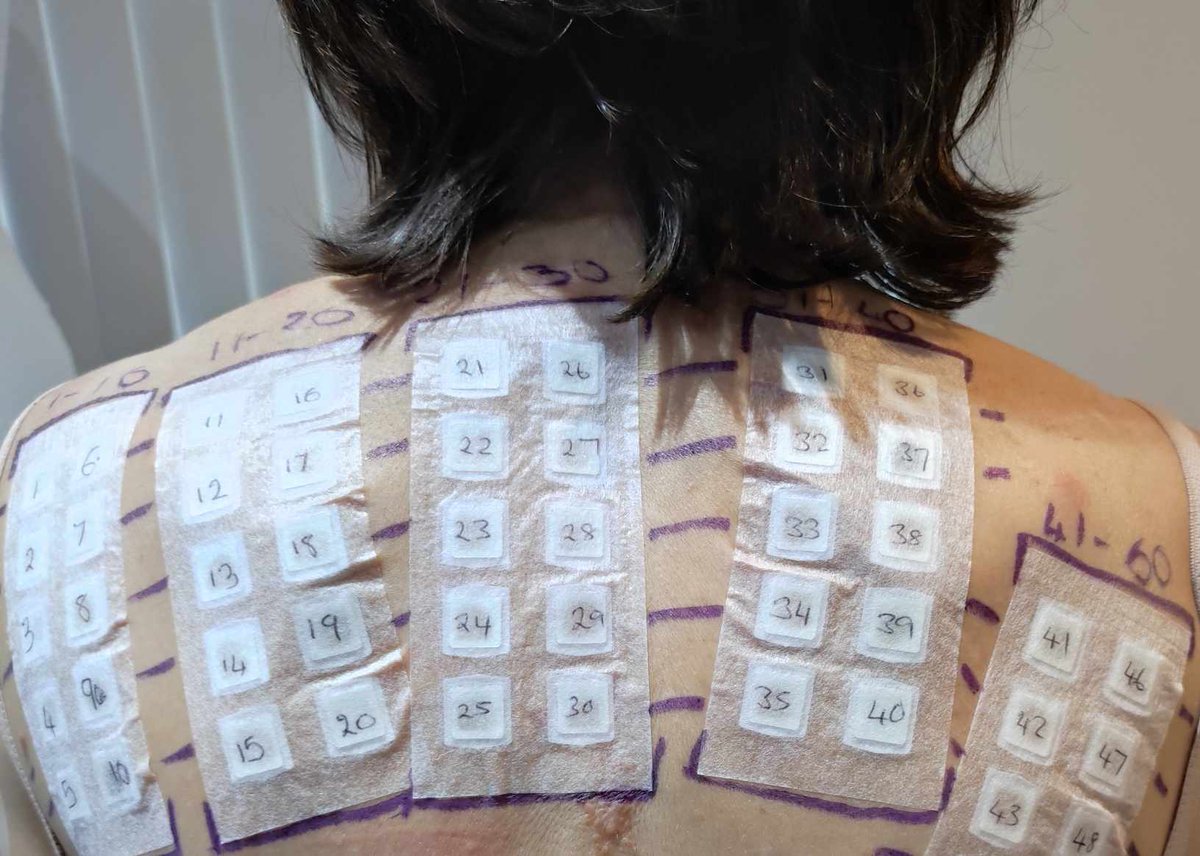 New post on Bonkers about Perfume...! "Sticky back plastic: my (historic) run in with seborrheic dermatitis, and testing perfumes in unusual places". bit.ly/2i63hzT