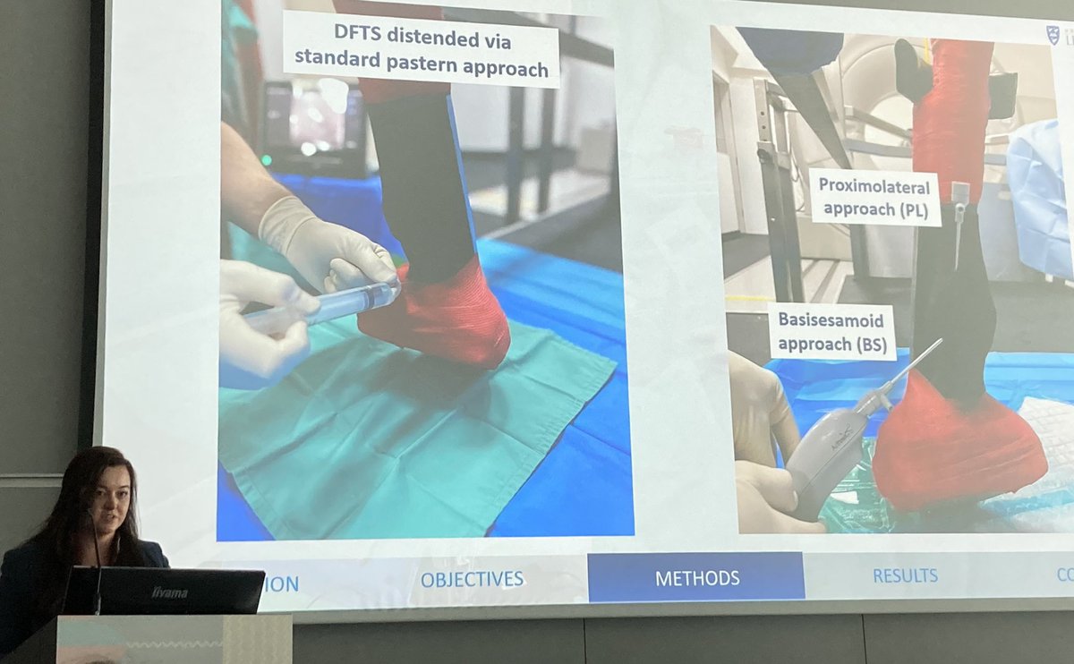 Connie Bowkett-Pritchard (@bowkettcon34945) on Twitter photo The University of Liverpool’s Louise Breen is now presenting exciting research on a standing nanoscopic approach to the digital flexor tendon sheath which has great clinical potential <a href="/EVJltd/">BEVA Journals</a> <a href="/BEVA_news/">BEVA</a> <a href="/EVJeditor/">Celia Marr</a> #BEVA2024 The University of Liverpool’s Louise Breen is now presenting exciting research on a standing nanoscopic approach to the digital flexor tendon sheath which has great clinical potential <a href="/EVJltd/">BEVA Journals</a> <a href="/BEVA_news/">BEVA</a> <a href="/EVJeditor/">Celia Marr</a> #BEVA2024