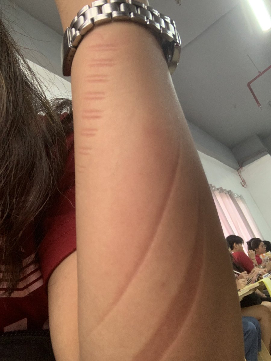 Aira “tulog every break” Fabros RN😭