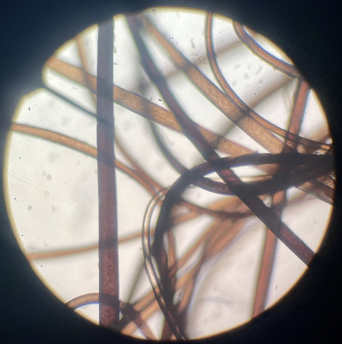 GlatzScience's tweet photo. Today in Biology Class, we are exploring the microscopic world!  Check out this mosquito larvae, flower petal, packaging material and hair!  Stay tuned for pics tomorrow from our Pond Water Safari!  GO COMETS!! https://t.co/lhbZXHf850