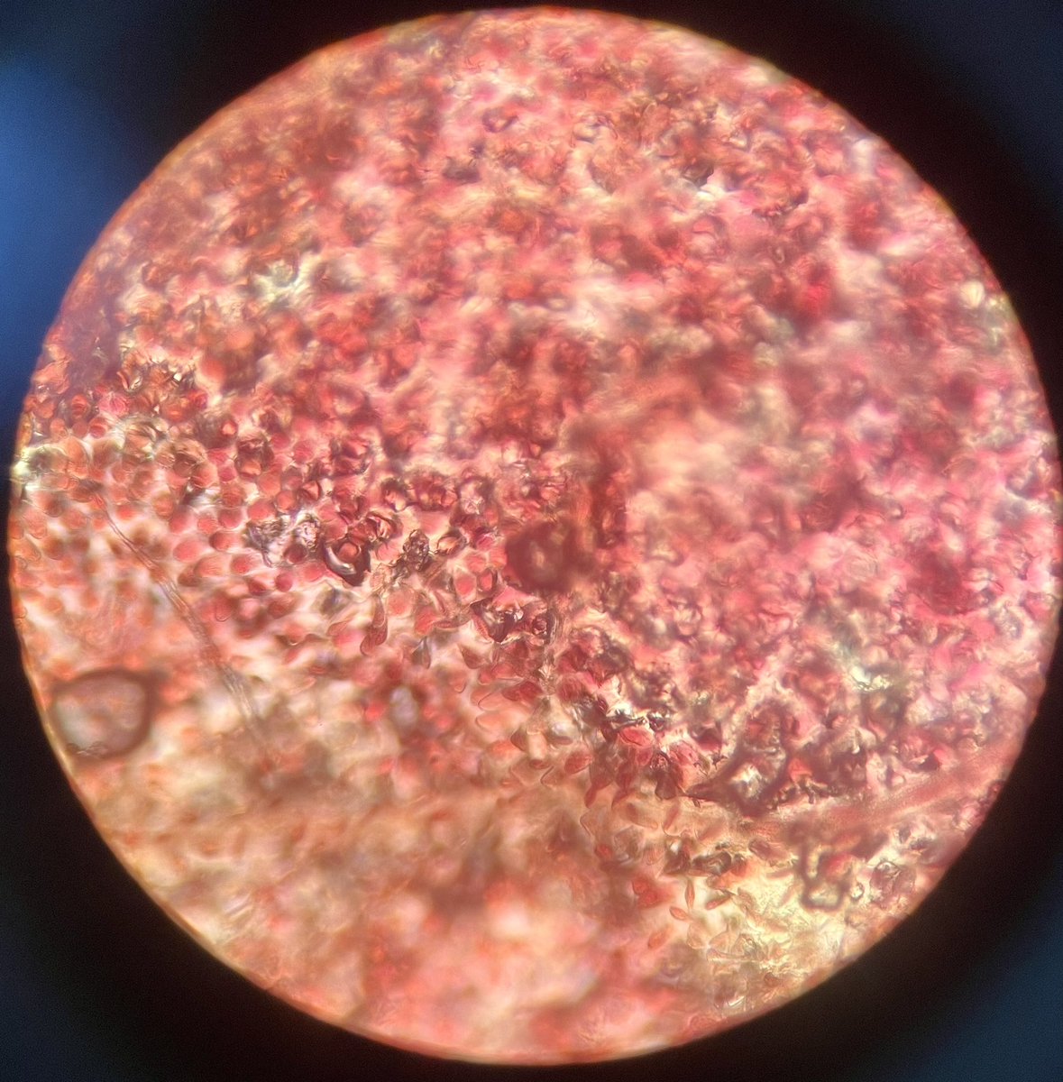 GlatzScience's tweet photo. Today in Biology Class, we are exploring the microscopic world!  Check out this mosquito larvae, flower petal, packaging material and hair!  Stay tuned for pics tomorrow from our Pond Water Safari!  GO COMETS!! https://t.co/lhbZXHf850