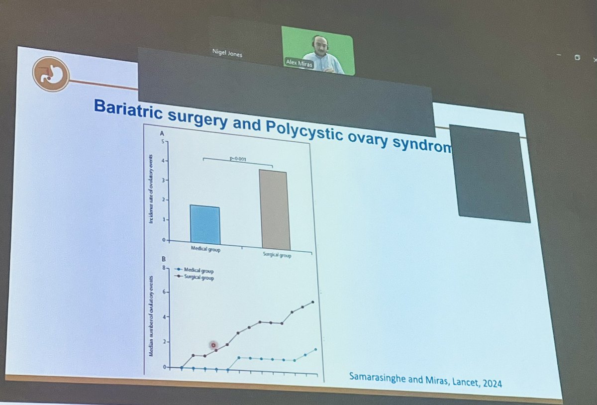 Anna Kamocka (@annakamocka) on Twitter photo Shift from monitoring weight loss to improvement in #obesity related complications, QoL and life expectancy as #obesitysurgery success measures.
Phenomenal talk by <a href="/AlexanderMiras/">Alex Miras</a> at #AUGIS2024 on current trends and future of research in #metabolic and #BariatricSurgery Shift from monitoring weight loss to improvement in #obesity related complications, QoL and life expectancy as #obesitysurgery success measures.
Phenomenal talk by <a href="/AlexanderMiras/">Alex Miras</a> at #AUGIS2024 on current trends and future of research in #metabolic and #BariatricSurgery