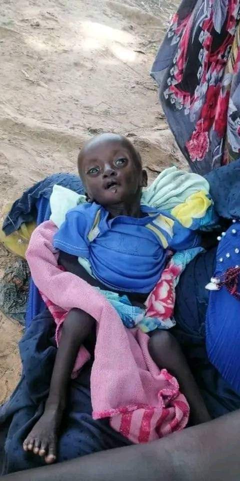khaberni's tweet photo. لحظة احتضار طفلة نازحة بسبب الجوع والجفاف في دارفور بالسودان. #خبرني https://t.co/8tAWKqg8KL