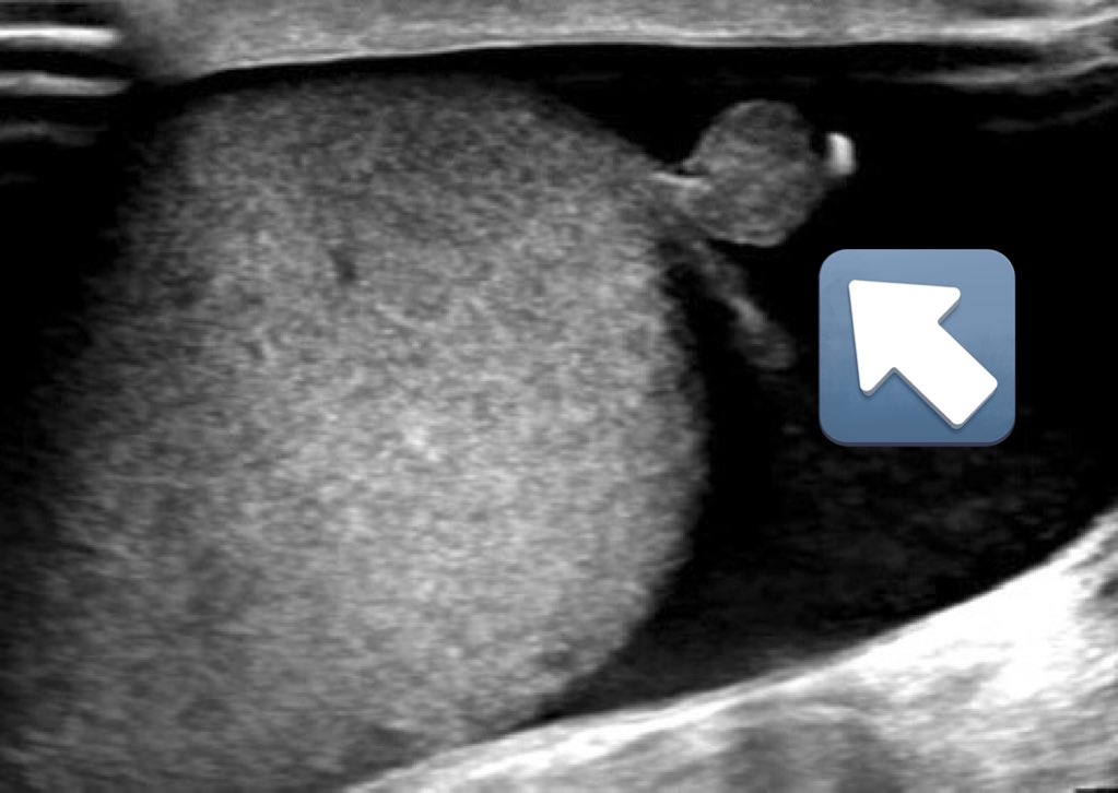 Paul McCoubrie tweet media